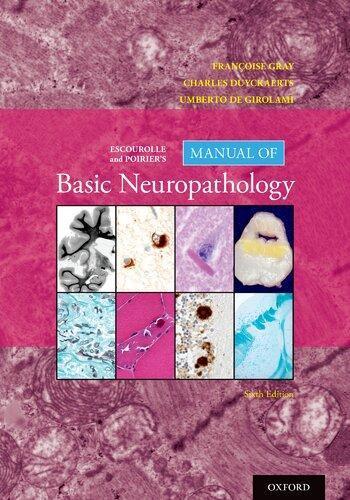 skihosevx: Escourolle And Poiriers Manual Of Basic Neuropathology 6Th Edition - skihosevxskihosevx: Escourolle And Poiriers Manual Of Basic Neuropathology 6Th EditionE-booksskihosevxskihosevxBSL-V2-8925E-books