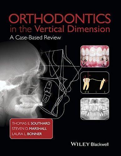 skihosevx: Orthodontics In The Vertical Dimension A Case Based Review - skihosevxskihosevx: Orthodontics In The Vertical Dimension A Case Based ReviewE-booksskihosevxskihosevxBSL-V2-8754E-books